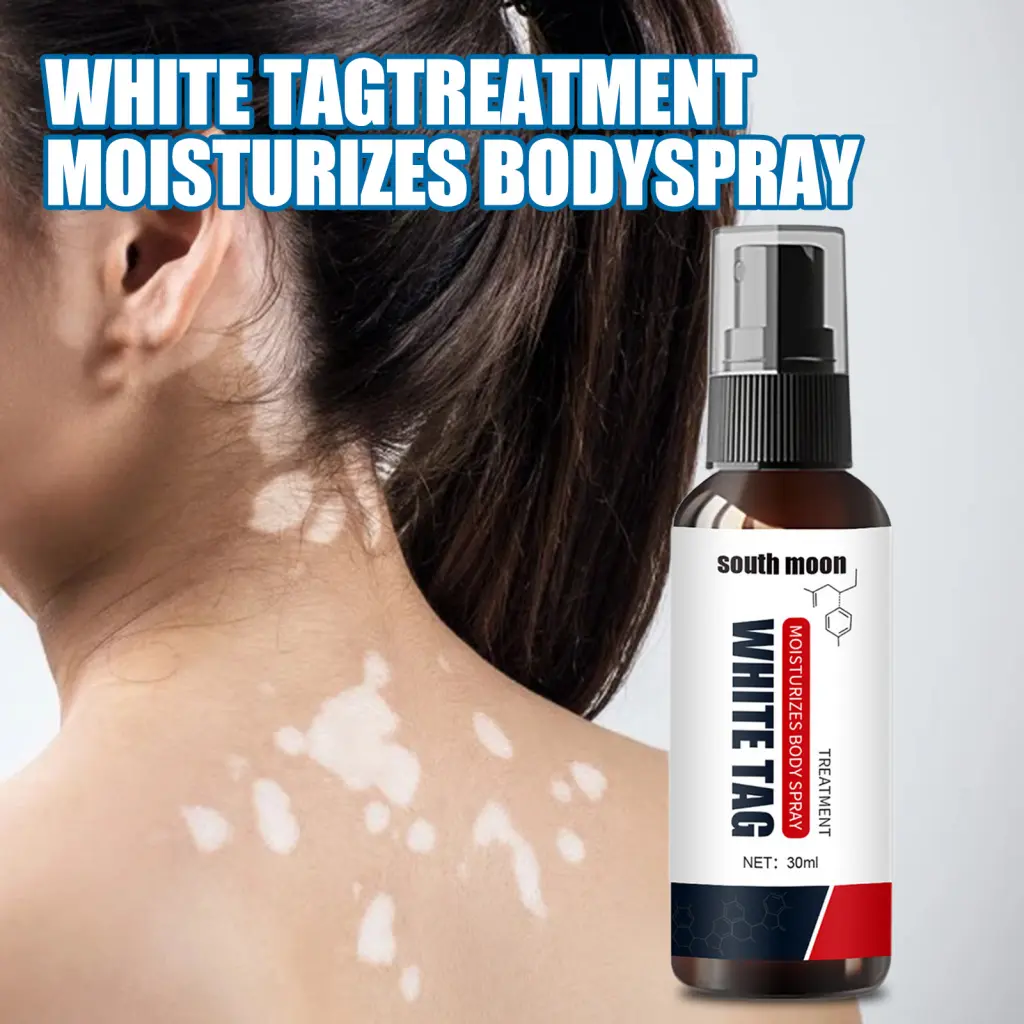 Xadnywa 30ml Vitiligo Therapeutic Serum Vintage Sweat Spot Liquid Compact White Tag Liquid Spray Effective Vintage White Tag Treatment Essential Serum Spray for Female Healthy