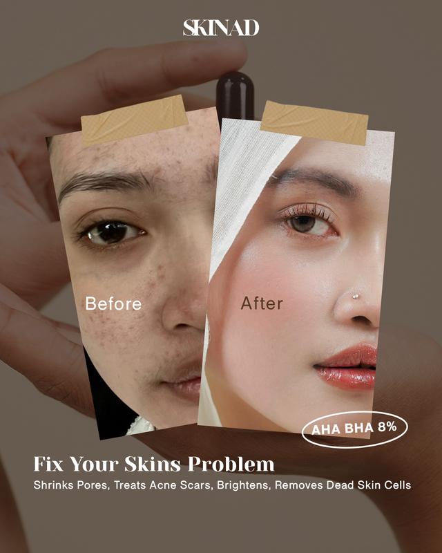 SKINAD AHA BHA PEELING SOLUTION (SERUM EXFOLIASI) Bundling 3 Pcs I Mengangkat sel kulit mati - Darkspot - Bruntusan - Mencerahkan - Mengontrol minyak - Mengecilkan pori-pori 4