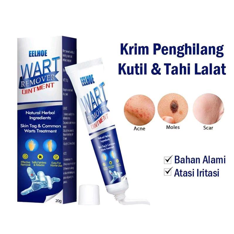 Cream Penghilang Tai Lalat Kutil Ampuh Wart Remover Skin Tag Oitment 0