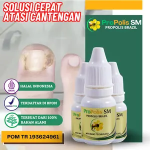 ProPolis SM Atasi Cantengan Jempol Kaki dan Jamur Kuku Kaki Tetes 6ml