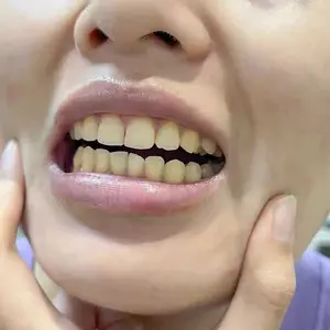 pembersih karang di gigi pemutih gigi kuning Pemutih gigi Teeth Whitening Powder Penghilang Karang Kuning Permanen 100% original Menghilangkan Noda Pemutih Gigi Bubuk 50g mengurangi noda pada gigi
