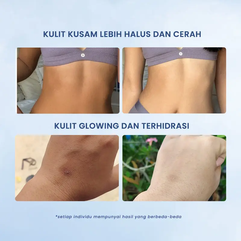 Brightening Body Day Tone Up ∣ SPF 30PA ++ USKINLAB ∣ Mencerahkan ∣ Melembabkan ∣ Lotion ∣ Melembutkan ∣ Pencerah Kulit Tubuh 3