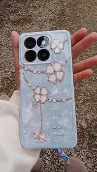 Product Review of Case Compatible With ZTE Blade A55 A35 Motif Fashion softcase Procamera Macaron Silikon TPU kesing cassing Casing Hp from A**p S**) 0