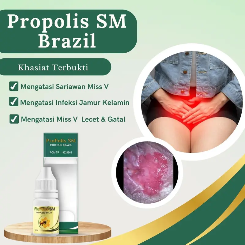 Propolis SM Untuk Sariawan Miss V Infeksi Jamur Kewanitaan Gatal Miss V Dan Lecet Keputihan Isi 6ml 0