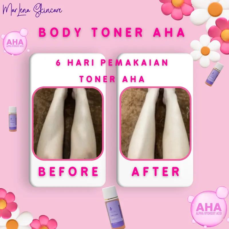 TONER BADAN MARLENA DNA SALMON BPOM FREE KAPAS BUNDLING 2 PCS  Mencerahkan 4