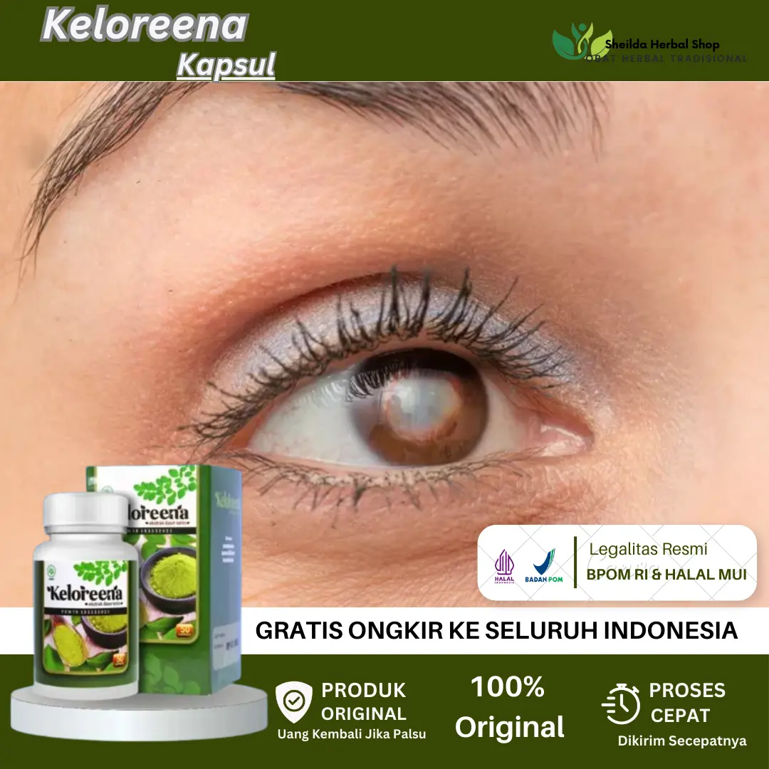 Keloreena obat Mata Berkabut, Mata Berbayang, Syaraf Mata Lemah, Syaraf Terjepit, Mata Buram, Vitamin Mata Kering