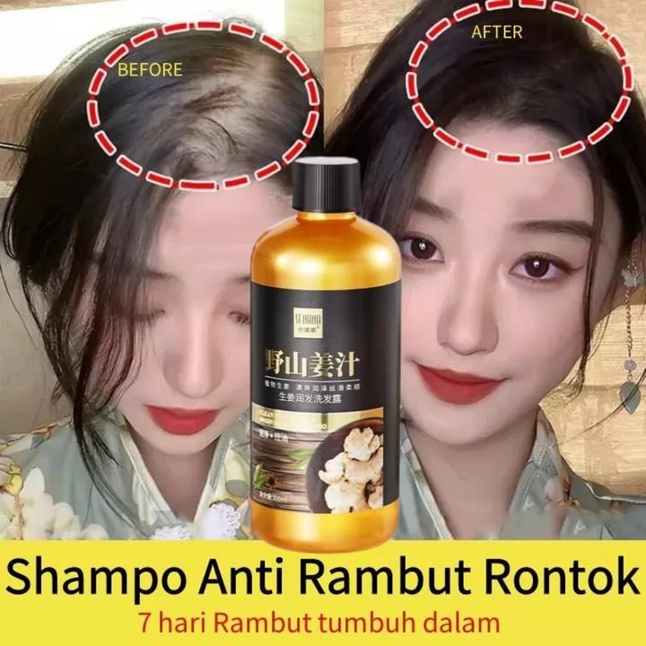 Shampo Penumbuh Rambut Cepat Ginger Shampoo 300ml Pertumbuhan Rambut ...