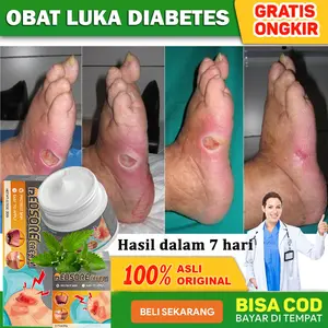 Salep Luka Diabetes 【COD】Salep Diabetes Paling Ampuh Salep Dekubitus Salep Untuk Luka Diabet Salep Luka Cepat Kering Bedsore Cream Salep Luka Pasca Operasi Salep Topical 20gr