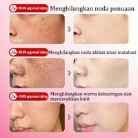 Gambar 【BPOM】Cream Pemutih Wajah Efektif Hilangkan Flek Hitam 20g anti-freckle Whitening Cream Penghilang Flek Hitam Membandel Niacinamide cream Siang Malam salep flek hitam Pemutih Wajah Krim Pemutih Penghilang Flek Hitam membandel - 20ML dari Sumifun Beauty Indonesia Kab. Bekasi 4 Tokopedia