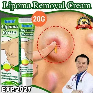 sumifun lipoma solusi ampun menghilangkan benjolan
