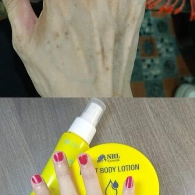 Hb Nrl moist body lotion bpom 5