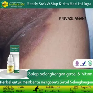 Propolis SM - Membantu mengatasi gatal di selangkangan, Mencerahkan area selangkangan, Tinea Cruris, Jamur di selangkangan