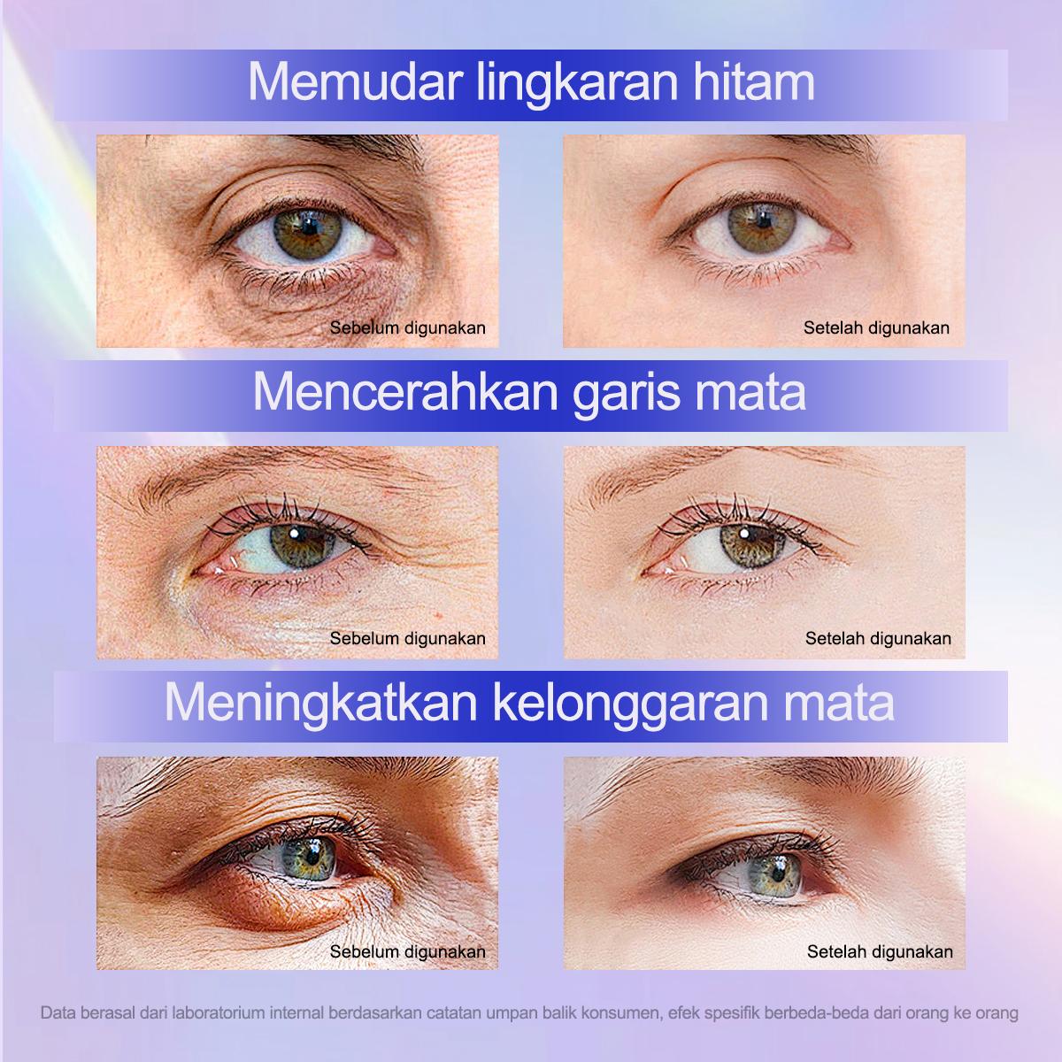 Krim Mata Retinol 5x Anti-Kerut 20ml / Krim Mata Retinol / Krim Mata untuk Lingkaran Hitam / Kantung Mata / Mencerahkan Wajah / Anti-Aging / Vitamin Mata / Krim Mata Panda / Menghilangkan Lingkaran Hitam (Dark Circle) / Skincare Perawatan Mata