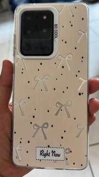 Product Review of Casing Ribbons for SAM A55 (5G) A54 A53 A52 A51 (4G) A50 A35 A34 A33 A32 A31 A25 A21S A20S A15 (4G 5G) A14 A13 A12 A11 A10S A05S A04E A03CORE A02S GALAXYA22 A70 A71 A72 NOTE20ULTRA 9 S10 S20 S21 S22 S23 S24 FE PRO PLUS PREMIUM MEWAH GIRLS case CYK0021 from v**i 0