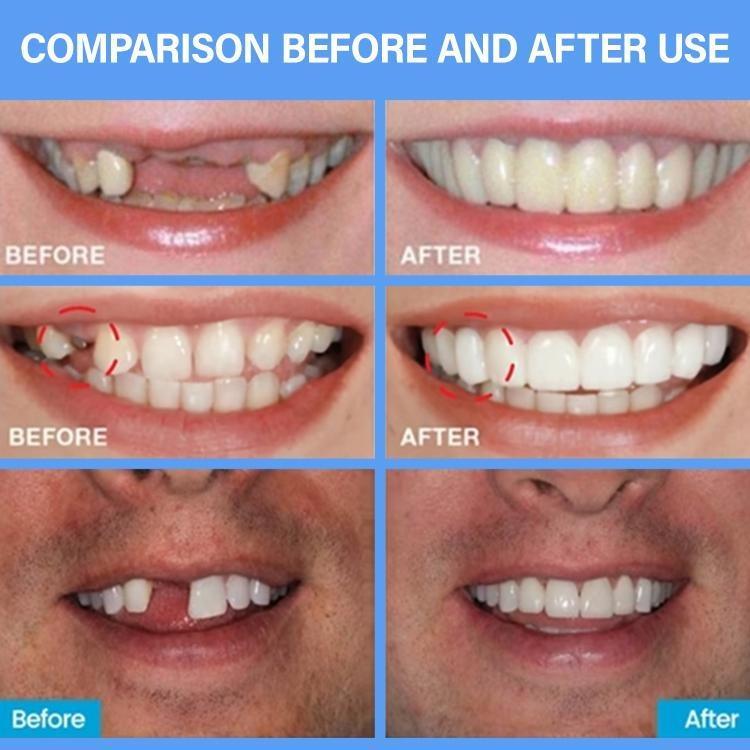 Dekorasi Gigi Gaya Film dan Televisi, Cairan Perbaikan Gigi Hilang yang Laris Dijual Meredakan Nyeri Gusi Ketidaknyamanan Mulut Pereda Sakit Gigi Perawatan Menyegarkan Perbaikan Pembersihan Perawatan Gigi Tetes Pereda Gigi
