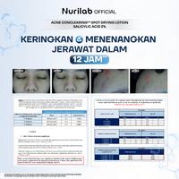 Gambar Nurilab - [Extra Promo New Formula] Jerawat Hilang, Bekas Lenyap! | Serum Concealer & Acne Conclearing Spot Drying Lotion Salicylic Acid 2% - 08 COOL dari Nurilab.id Kota Tangerang 5 Tokopedia