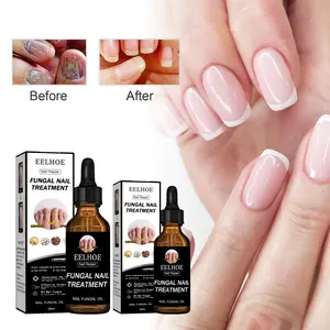 Nail Repair Essence Serum Original Serum KukuPerawatan Kuku Berjamur Serum PenghilangJamur Di Kuku Vitamin Kuku Rusak PerawatanJamur Kuku