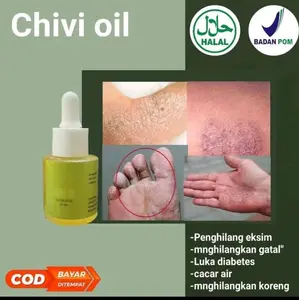 CHIVIOIL PENGHILANG BEKAS LUKA DAN GATAL GATAL Organik