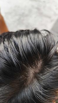 Product Review of Minyak Kemiri bakar murni Erdila penumbuh rambut 100% PURE ORIGINAL Menebalkan Menumbuhkan from W**y 2