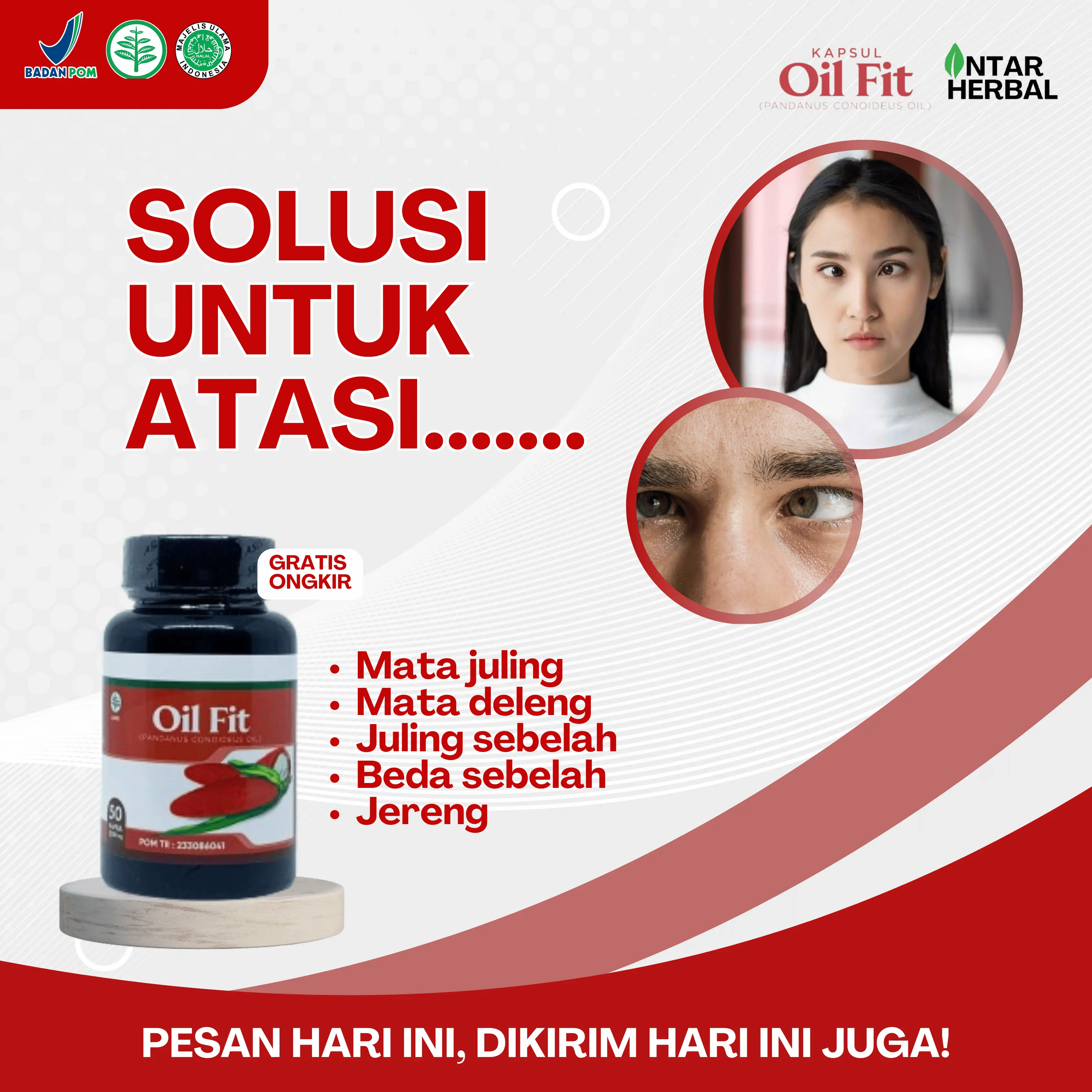 Suplemen Kesehatan Mata OilFit Untuk Mata Juling, Juling Sebelah, Juling Keluar, Mata Julang Pada Anak/Bayi, Mata Deleng Menonjol Keluar