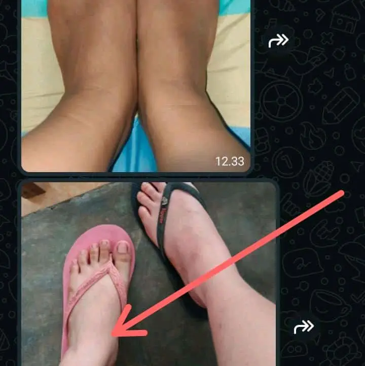 bostter elvy beauty pemutih badan ampuh Pencerah 10x lebih cepat 4