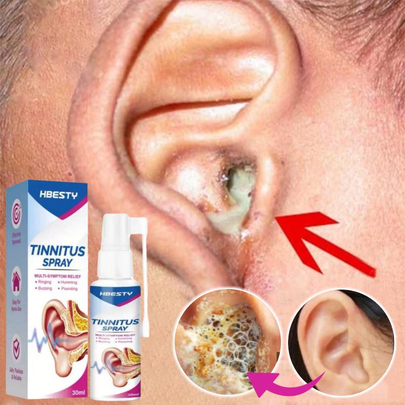 Obat Tetes Telinga Pembersih Telinga Obat Penyumbat Telinga Semprotan Tinnitus Pengobatan Sakit Telinga - Beli 2 gratis 1