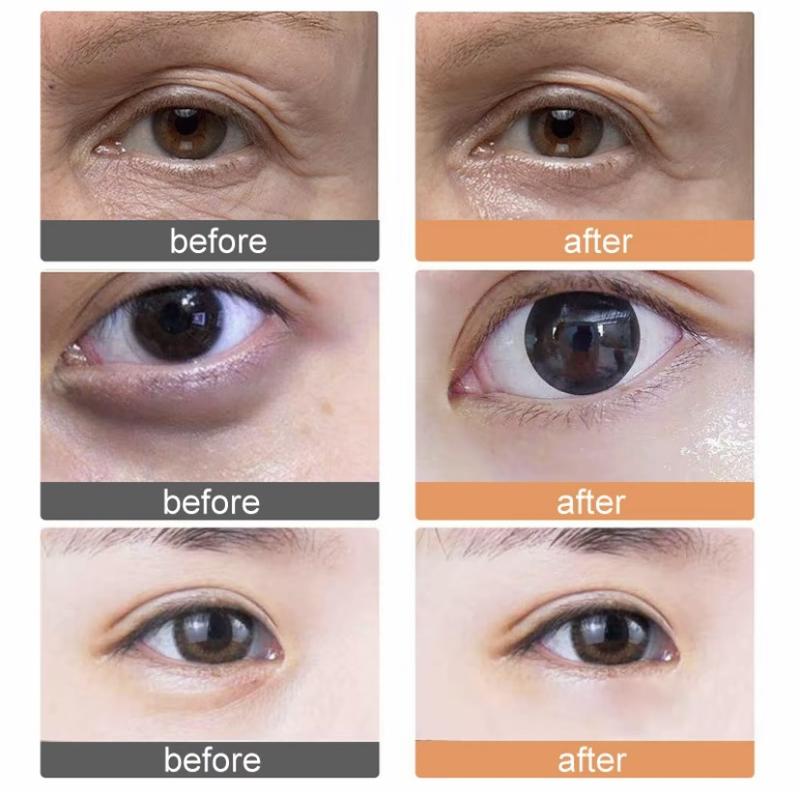 Krim Mata 5x Retinol – Anti-Kerut, Cegah Penuaan, Hilangkan Bengkak Mata & Kerutan, Cerahkan Lingkaran Hitam, Kencangkan Kulit, Solusi untuk Kulit Kendur/Kerutan Halus/Bengkak Mata Eye Perawatan Mengencangkan Wajah