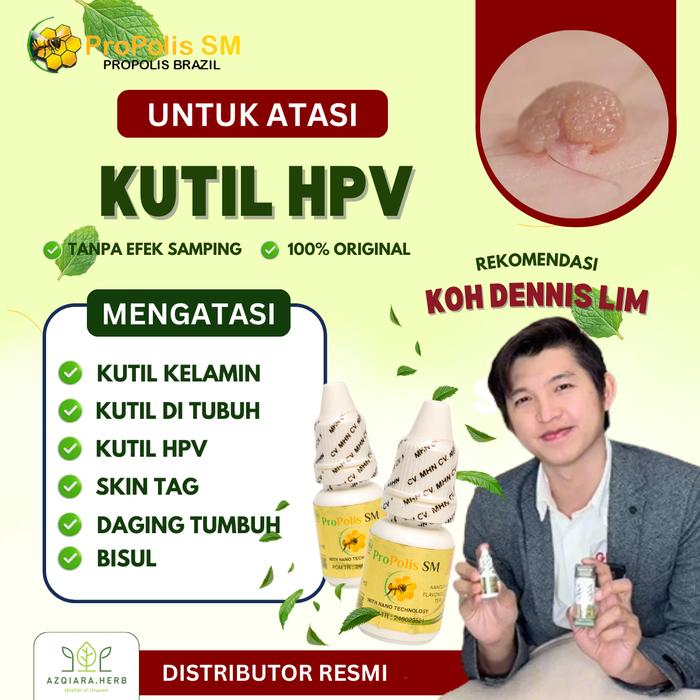 Gambar PROPOLIS SM Tetes Kulit HPV, Penghilang Kutil Di Seluruh Tubuh, Perontok Kutil Hpv, Daging Tumbuh, Bisulan, Tiroid Dengan Propolis Sm Isi 6Ml dari azqiaraherbal Kota Bandung Tokopedia