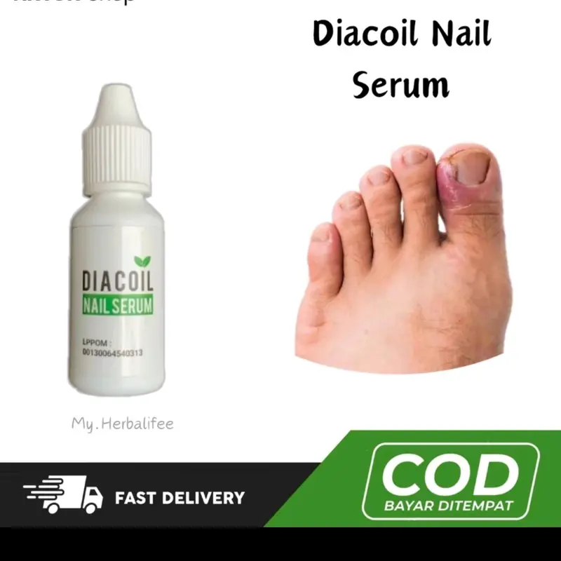 TETES KUKU CANTENGAN DIACOIL NAIL SERUM ATASI KUKU CANTENGAN 2