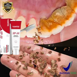 pemutih gigi kuning Pasta Gigi SP 10 - Probiotik segar dan cerah, menghilangkan plak membandel, membersihkan karang gigi, memutihkan gigi, membersihkan gigi kuning, karang gigi, menyegarkan nafas, menyeimbangkan bakteri mulut