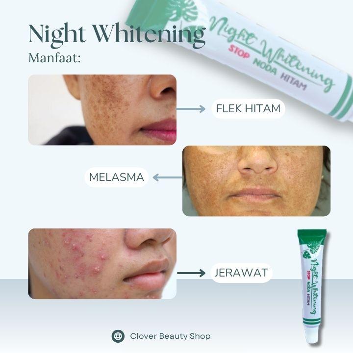 Liz Skincare Paket 2 in 1 Pemutih Malam (KPM) - Cream Pemutih Siang Malam ( Salep Penghilang Flek Hitam ) Wajah Pencerah 3