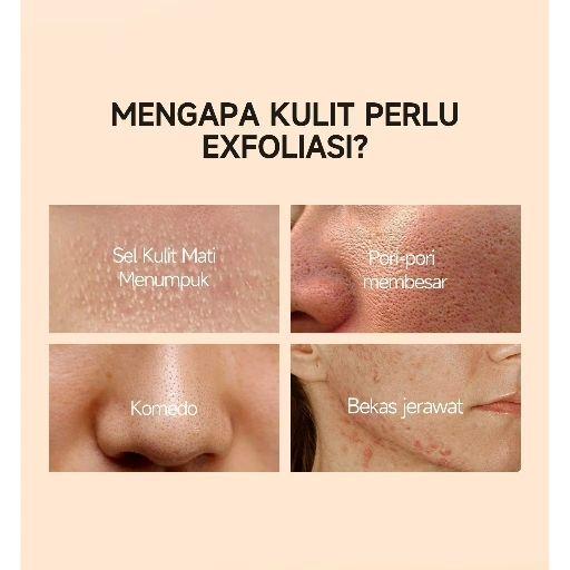 Product Introduction of GMEELAN Orange Exfoliating Gel 50g mencerahkan wajah dan mengangkat komedo 8