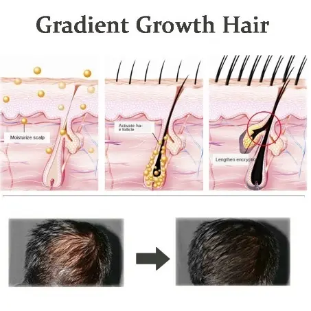 DEVNEN sampo anti rambut rontok 300ML Hair Growth Shampoo shampo penumbuh rambut cepat Anti rambut rontok Botak ginger shampoo kontrol minyak menyegarkan pelembab nutrisi Conditioner Haircare Ketombe Lebat 7