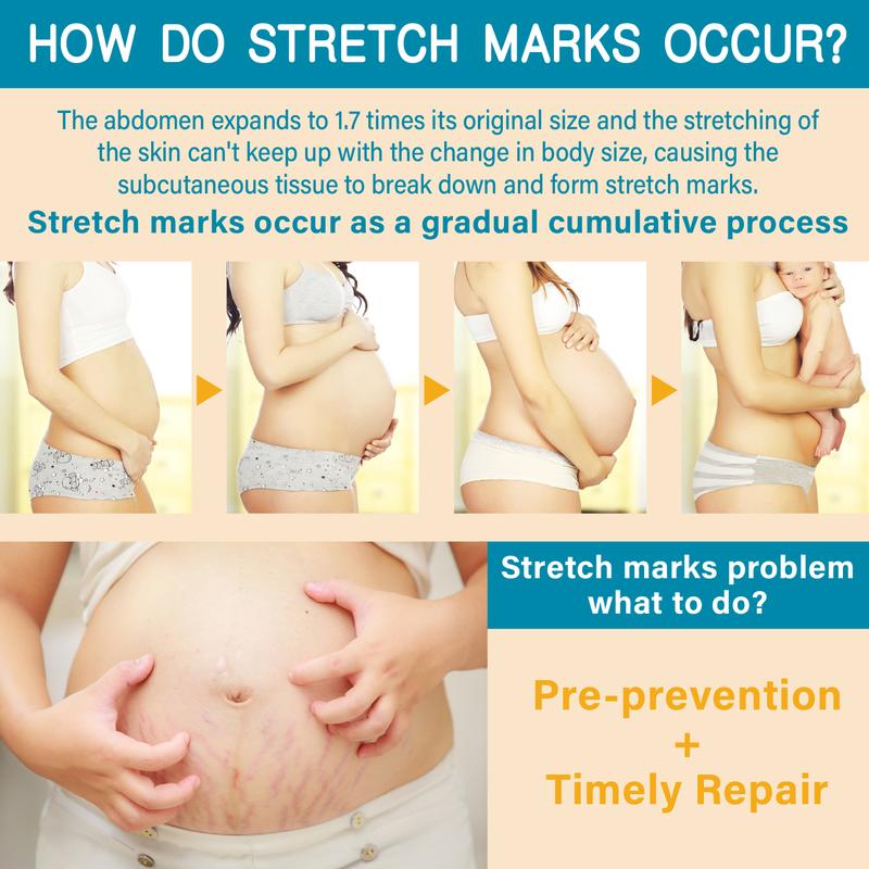 Product Introduction of Body Milk for Stretch Marks, Pregnancy Skin Care Helps Prevent Stretch Marks, Body Moisturizer 10.1 oz 0