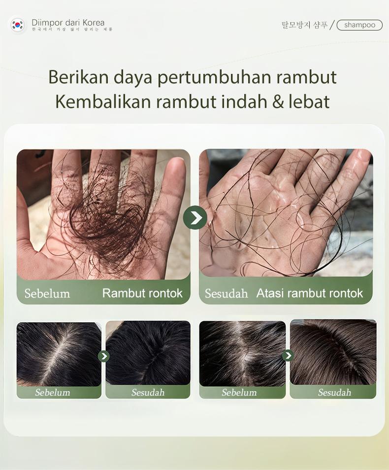 Dr.ville Shampoo Anti Rontok & Penumbuh Rambut Cepat - Sampo Nutrisi Akar Rambut Bervolume Anti Lepek Halus Berkilau Original  500ml