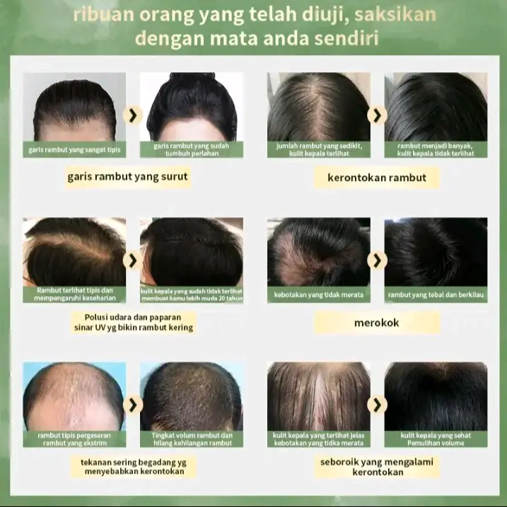 Ebelin Gingseng Shampo Ekstrak Herbal Alami Anti Hair Fall 300ml 5