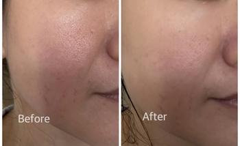 Product Review of 【MW】LM-COS0072 LASSIE MANNA AMINO ACID CLEANSING FOAM Facial Cleansing Facial  Wash. from p**n 0