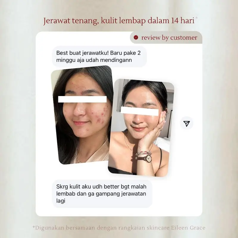 [SPECIAL LIVE] EILEEN GRACE - Moisturize Rose Jelly Mask 300 ml | Masker / skincare jerawat I Kulit kering sensitif | Bekas jerawat | Kemerahan | Bruntusan | Bopeng 3