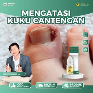 Propolis SM Untuk Atasi Kuku Kaki Cantengan, Cantengan Jempol Kaki Dan Tangan, Jamur Kuku, Kuku Rusak Berjamur, Bernanah Nyeri Asli 100% Original