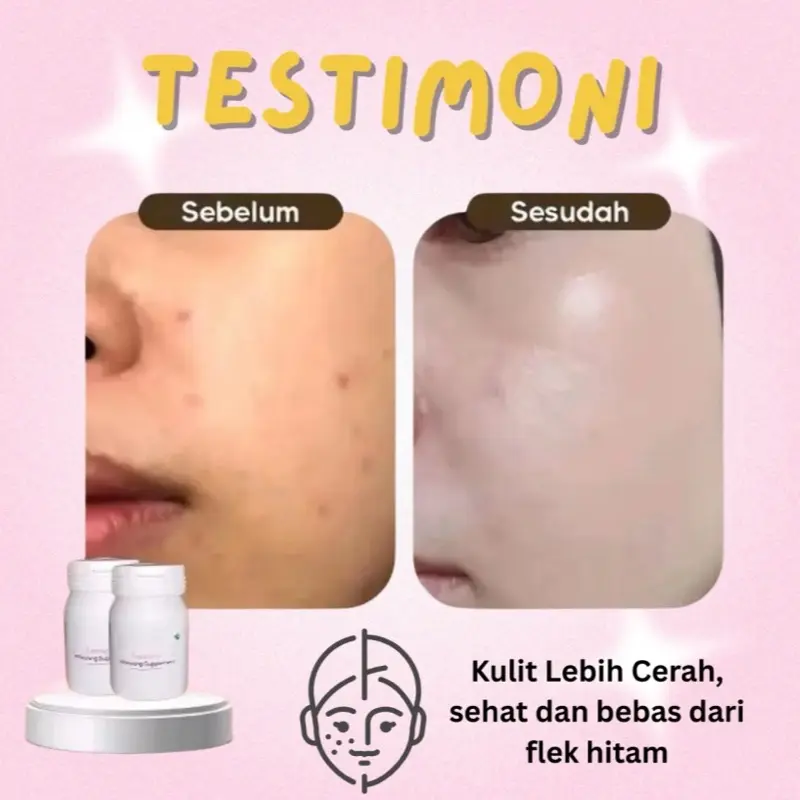 FEMINA WHITENING ORIGINAL MENCERAHKAN KULIT SEHAT CERAH BPOM AMAN 3
