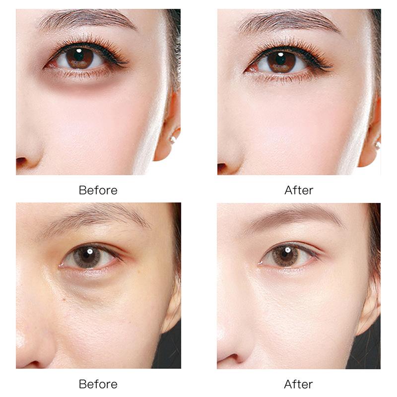 60 miếng mặt nạ mắt VHA – Dưỡng ẩm sâu, cấp nước & chăm sóc vùng da quanh mắt với Hyaluronic Acid 1