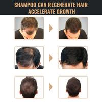 Gambar 100ml Root Activating Shampoo Penebalan Rambut Perawatan Pertumbuhan Kembali Anti Rambut Rontok - 1PCS dari Polkadope Indonesia Kota Tangerang 5 Tokopedia