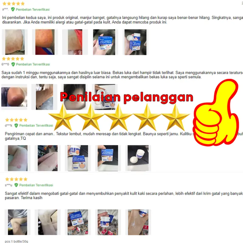South Moon Salep Khusus Psoriasis - psoriasis ointment - Kurap Pada Kulit Kepala - Kutu Air - Kurap Pada Badan - Eksim - Infeksi Kulit - Obat Luar Mengatasi Gatal 20g Perawatan Tubuh Kering Pembersihan 6