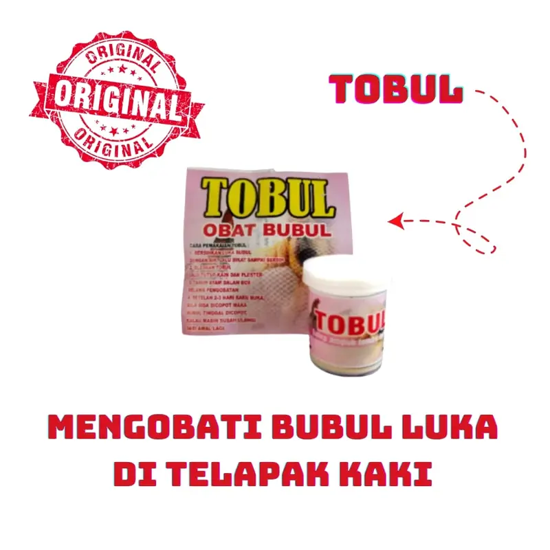 TOBUL obat bubul - obat bubul ayam di telapak kaki 0