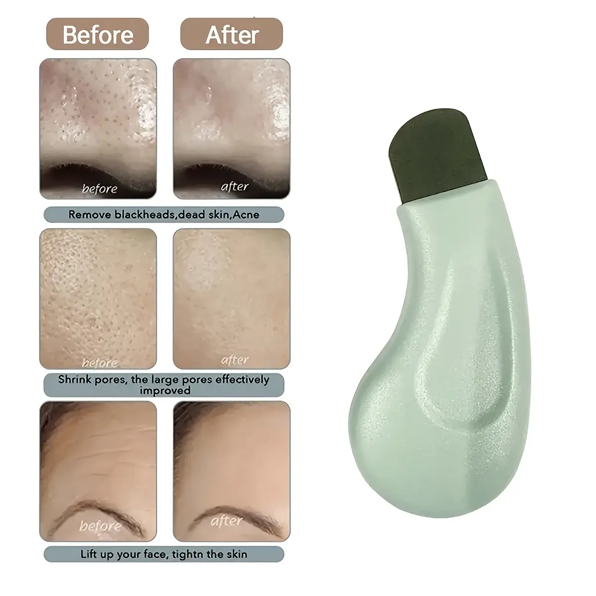 Blackhead Removal Shovel Exfoliating Acne Silicone Shovel Facial Hair Follicle Cleaner Suitable for Individual Beauty Salon Beauty Tools