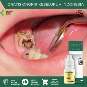 Propolis SM Tetes Sakit Gigi Berlubang, Cairan Tetes Perontok Akar Gigi Berlubang, Penghilang Sisa Gigi Berlubang, Gigi Goyang, Gigi Bolong, Perawatan Gusi