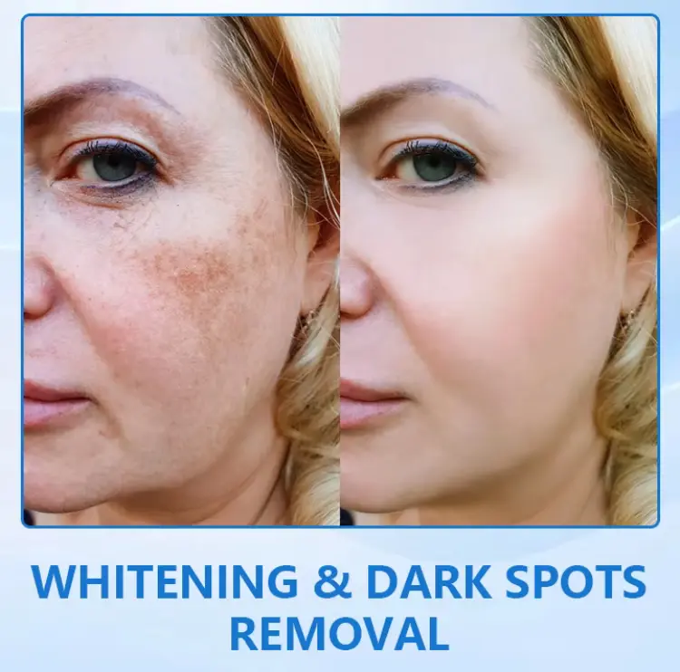 Tks LuxeLift B5 Mentega Muda Pengencang Kulit Wajah Moisturizer Mencerahkan Hitam Penyegar 7