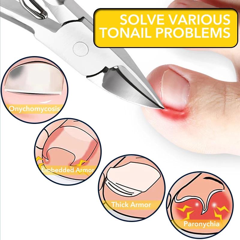 Nail Cutter Paronychia Tool Dead Skin Remove New Scissors Toenail Clippers 2