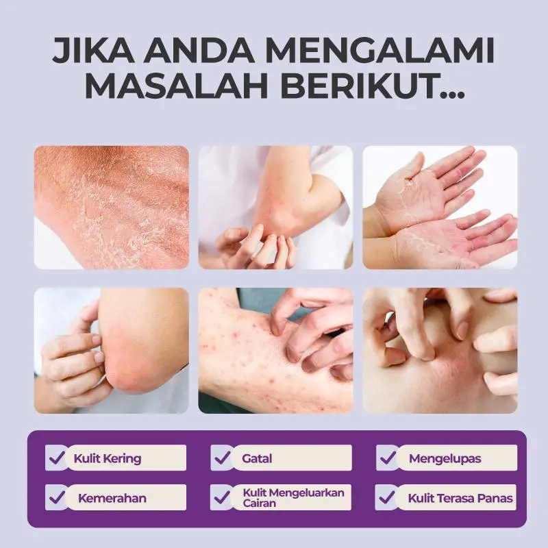 Application on Skin