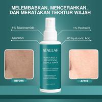 Gambar ATALLAH Moisturize & Brightening Essence Toner 100 ML | Toner Wajah Pria | Menyeimbangkan PH Kulit Wajah | Mencerahkan Wajah dari ATALLAH Kab. Bekasi 3 Tokopedia